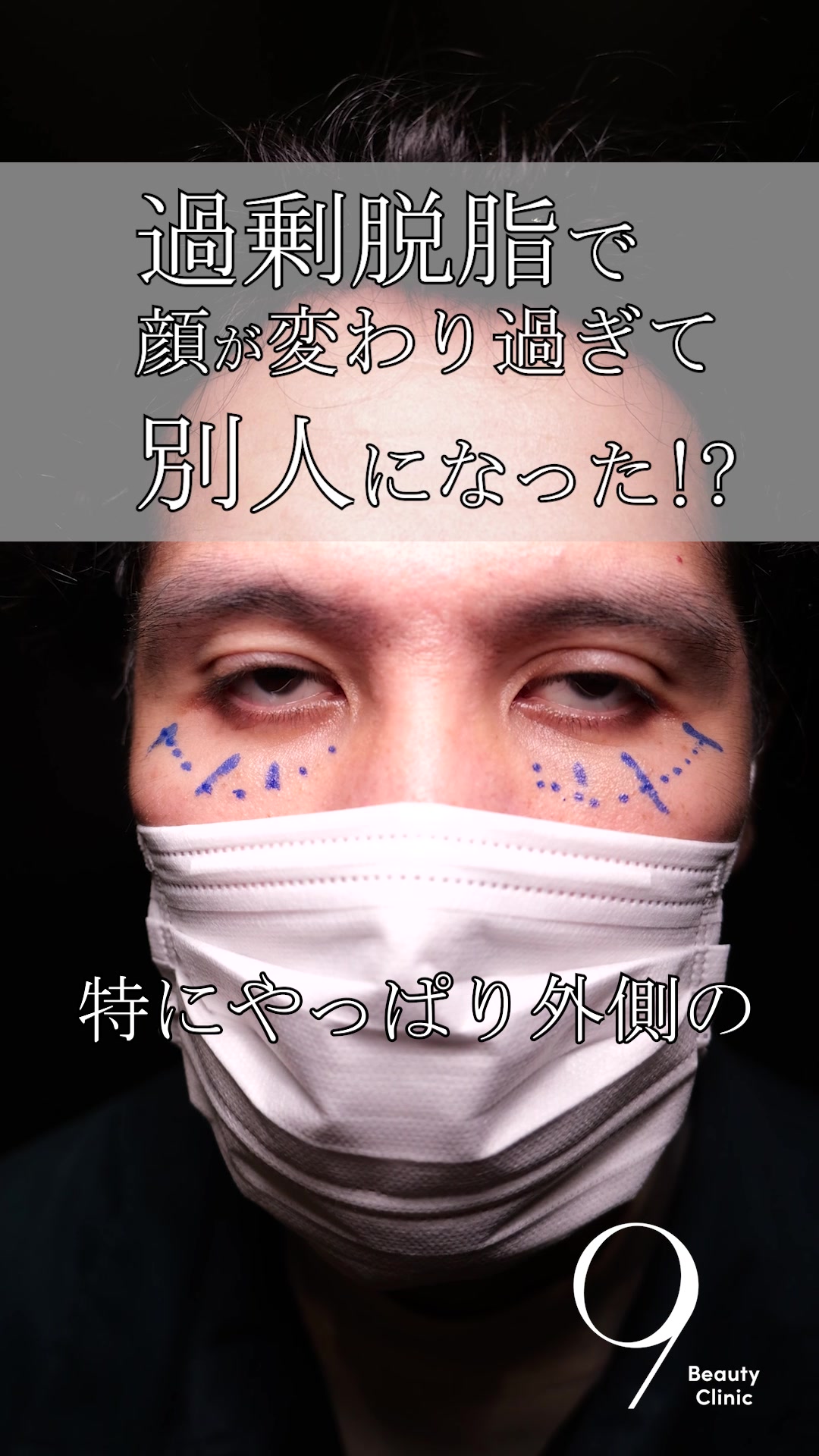 @りく先生　目元切開/クマ治療