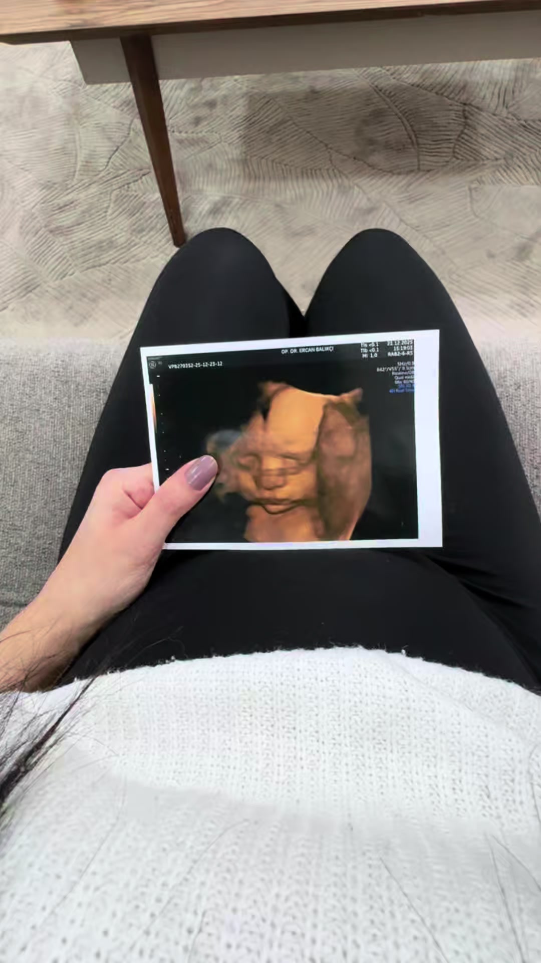 @Nuran Aydın Demir