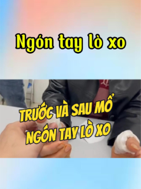 @Chuyên gia xương khớp