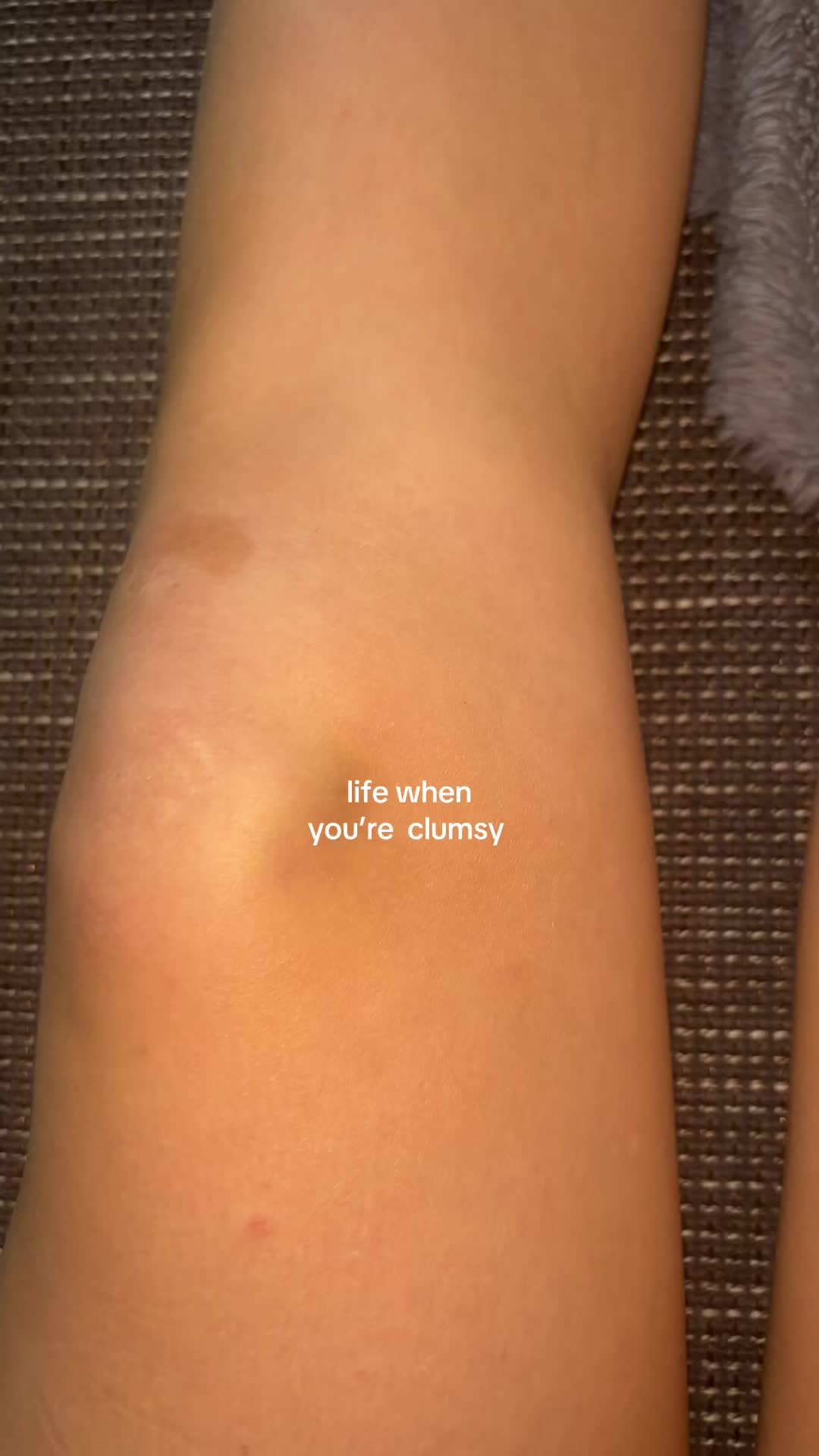 @anni🌟