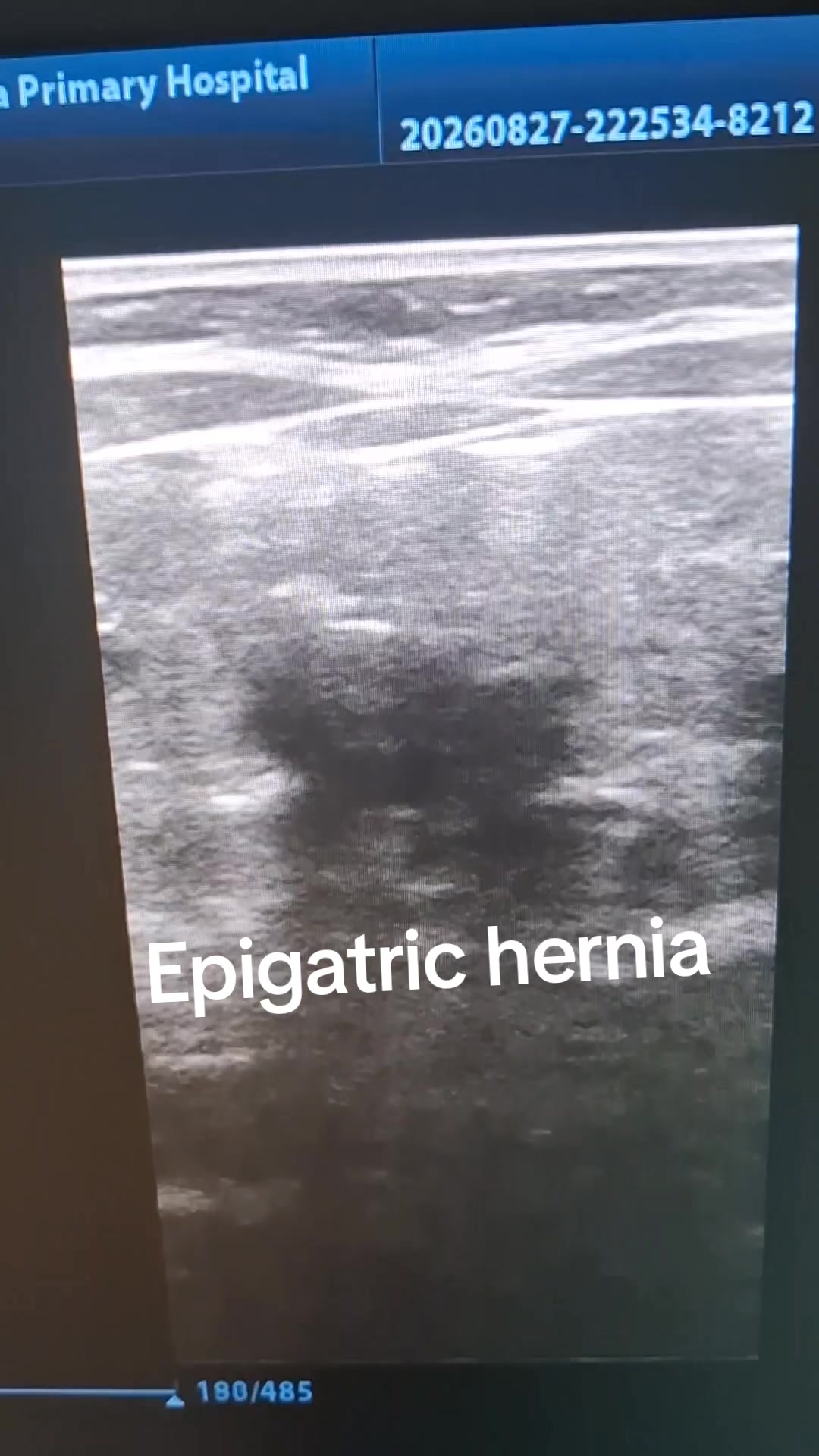 @Dr Wubie Endalew(Radiologist)