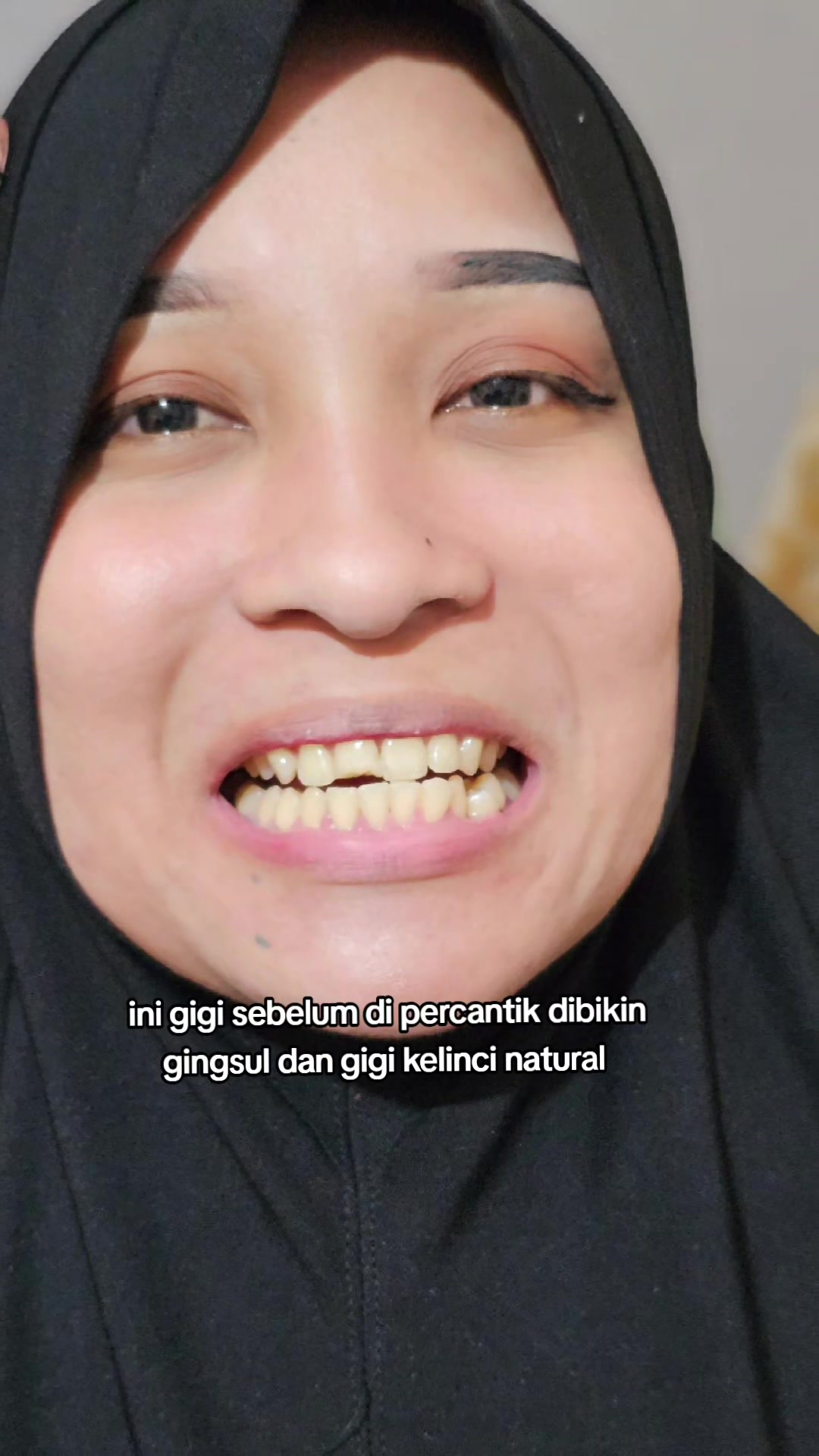 @fiqy gigi
