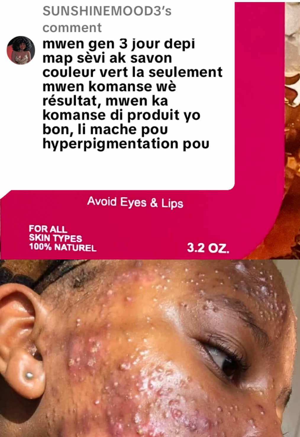 @Myriane Corriolan Official