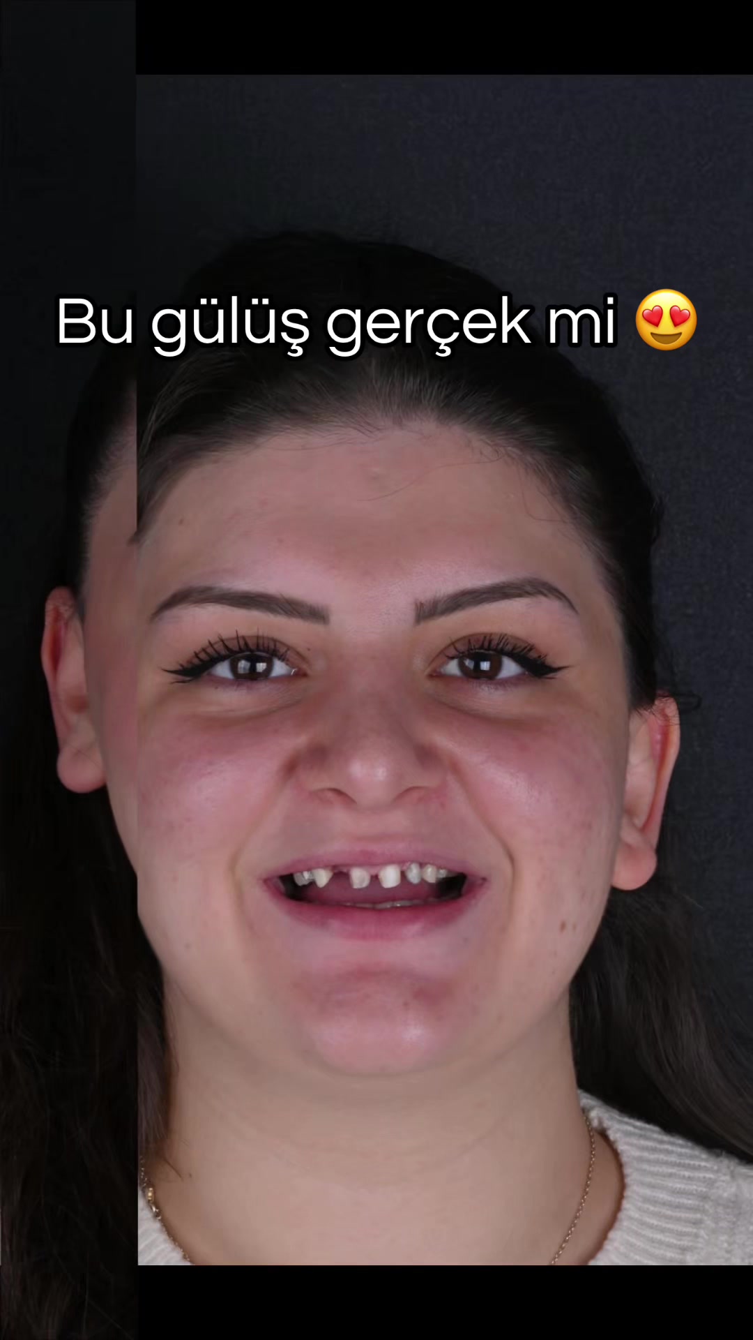 @Diş Hekimi Handenur Duru
