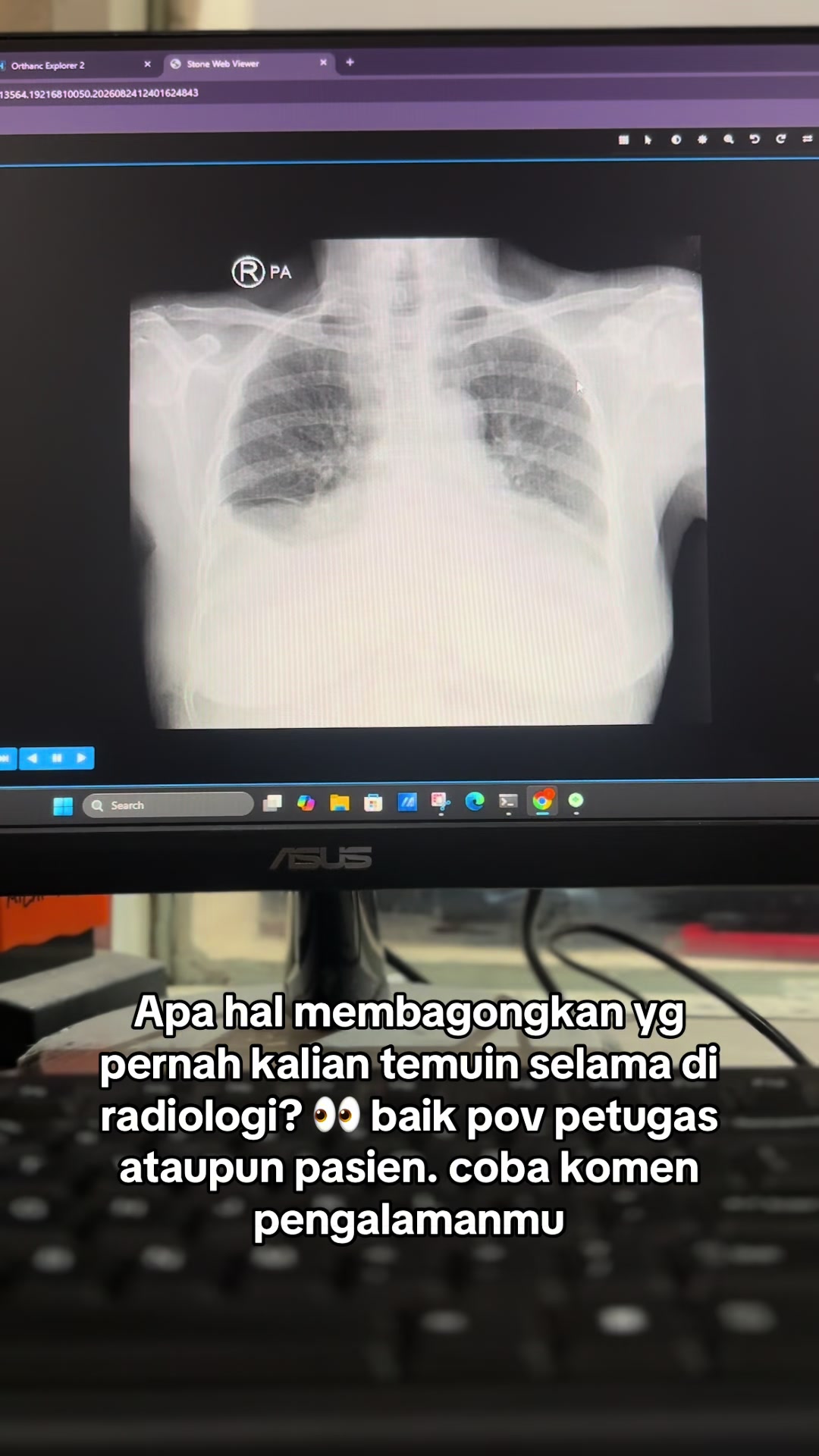 @Sobat Radiology