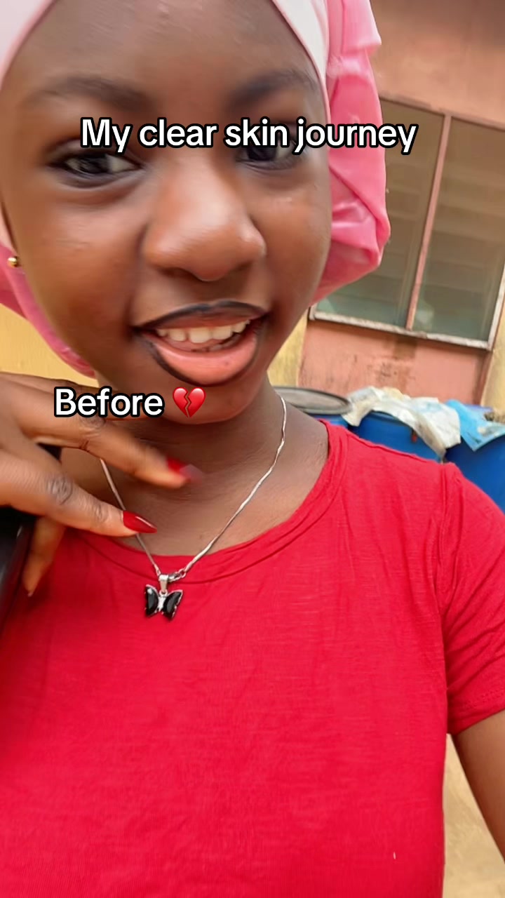 @ademide💕😩