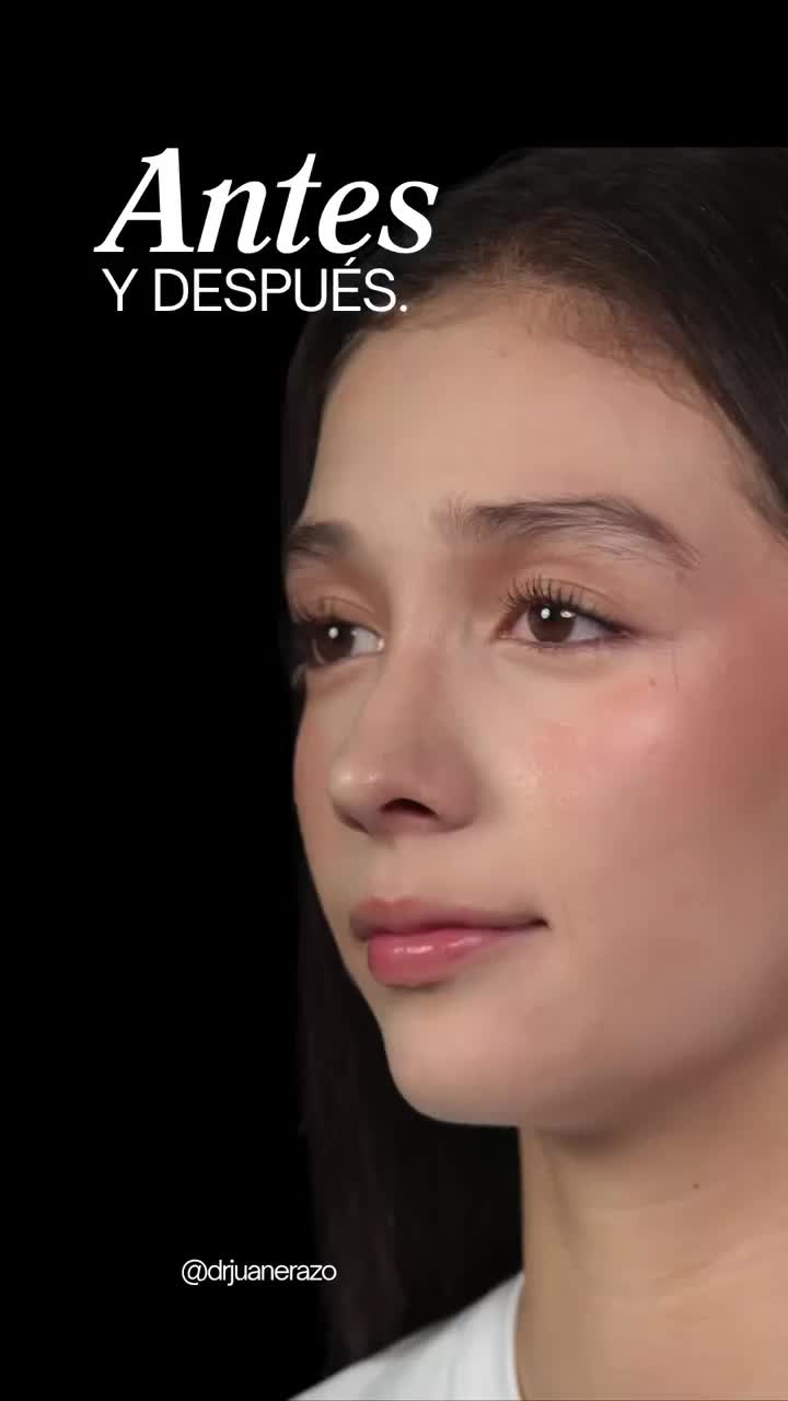 @Dr. Juan Erazo