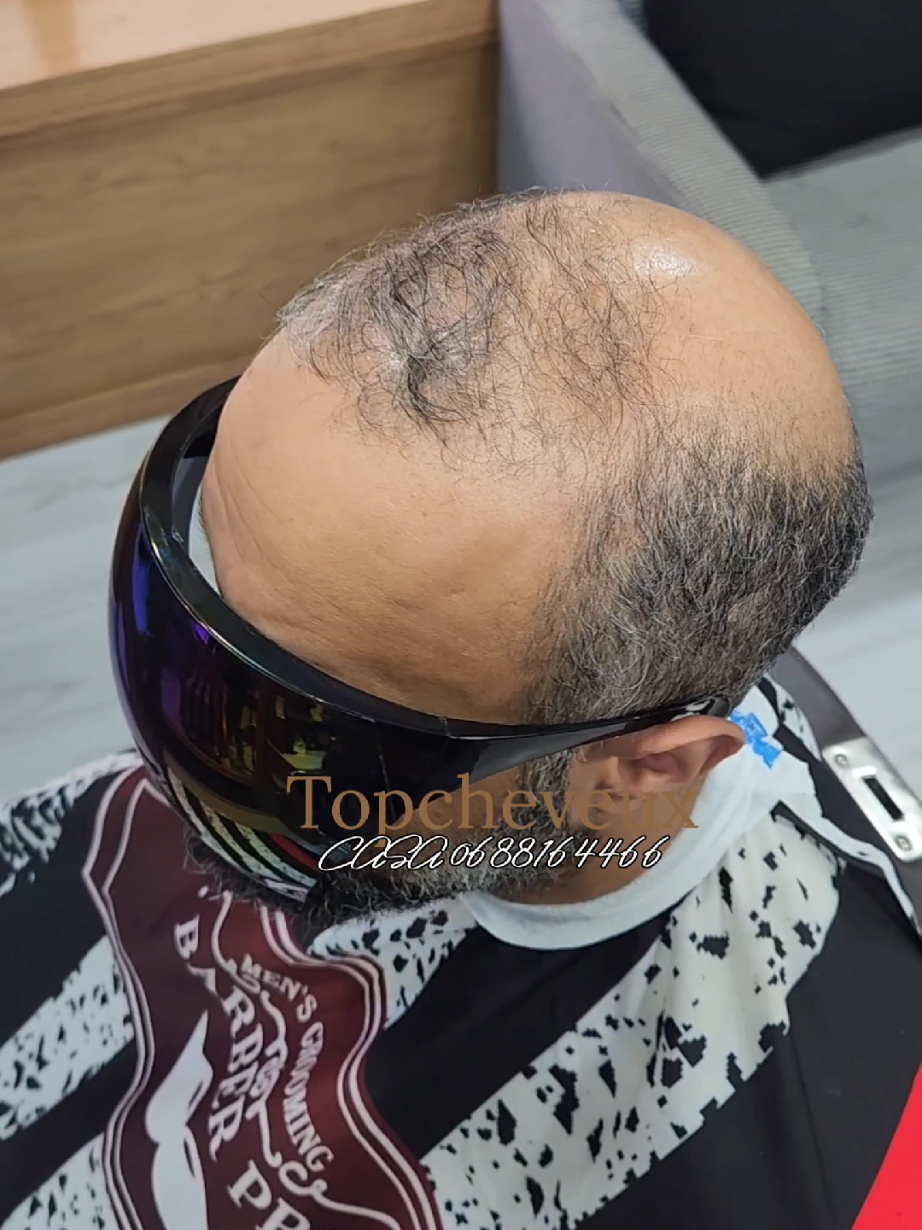 @top cheveux