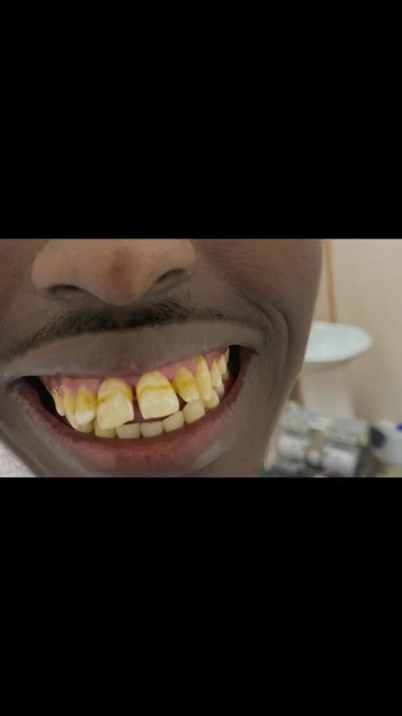 @Dr.Naasir🦷🩵🩺