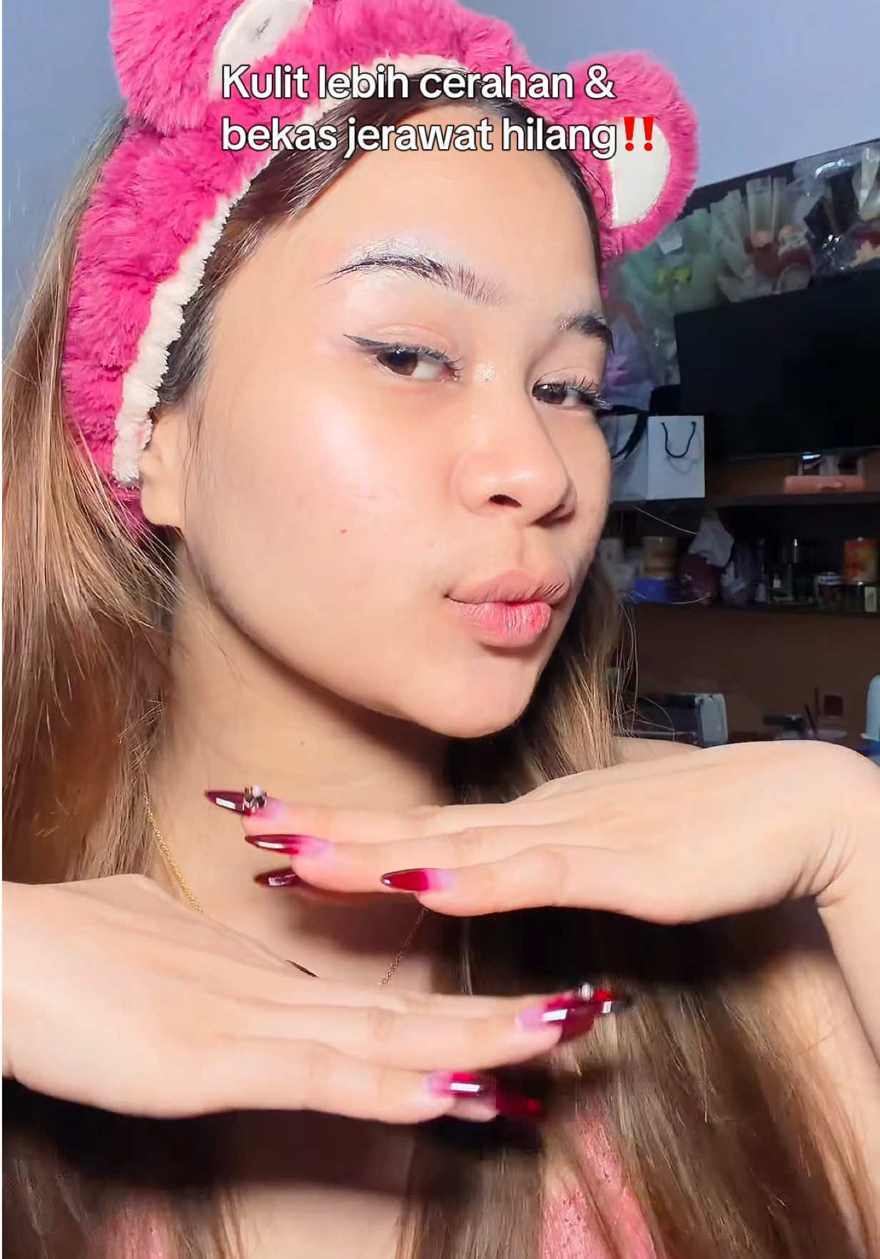 @-