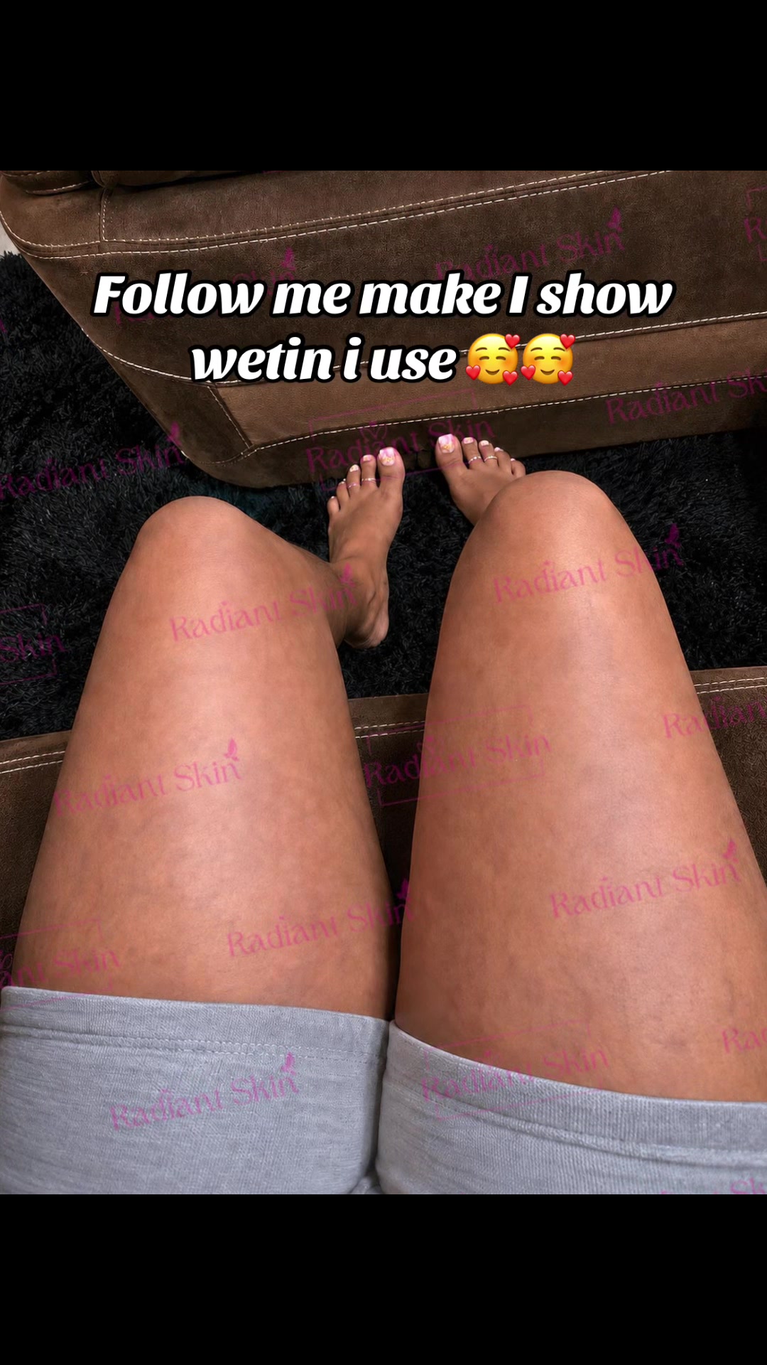 @Radiant skin