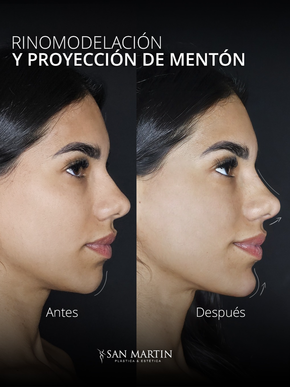 @Cl&iacute;nica San Mart&iacute;n