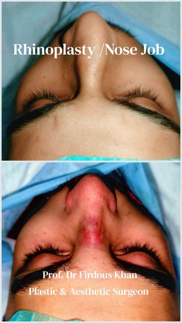 @Dr Firdous Khan PlasticSurgeon