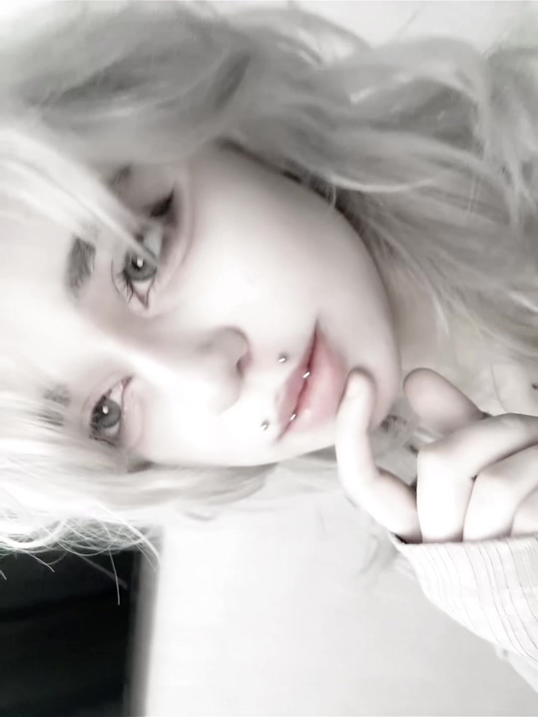 @uglyrosis
