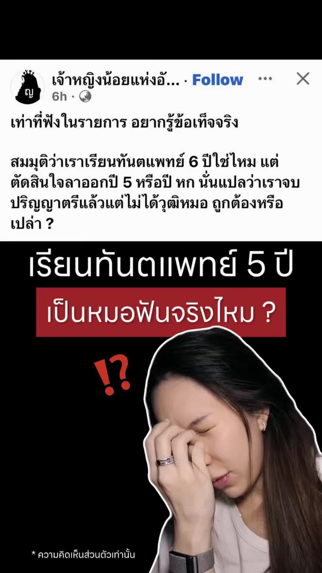 @หมอป่องสวยมาก veneer 🦷