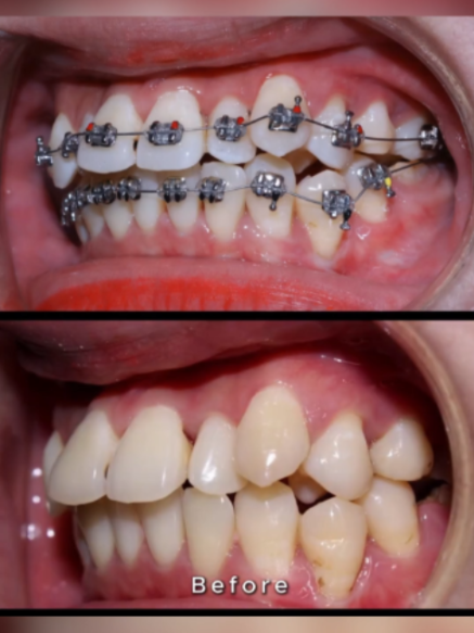 @Tech Dental