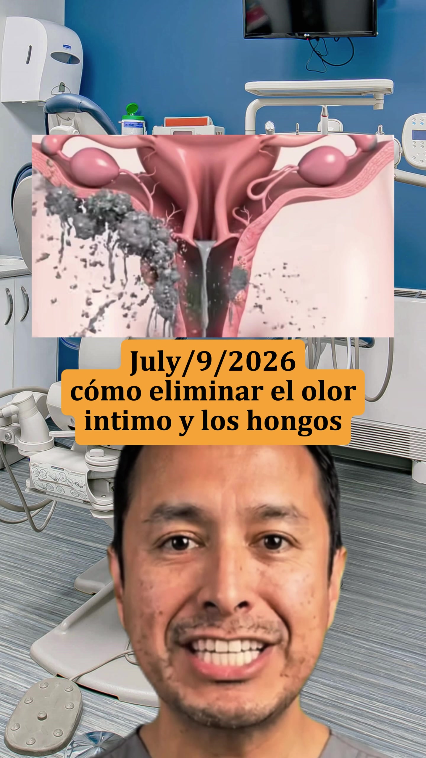 @b11uacmo