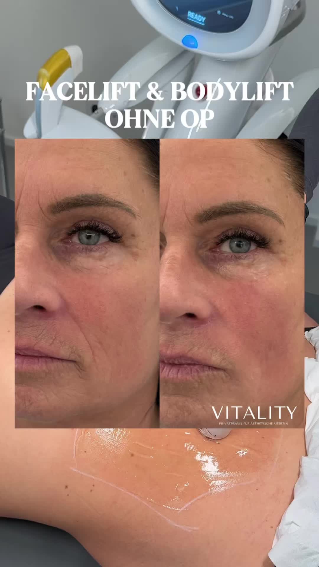@Melissa | BEAUTYEXPERT
