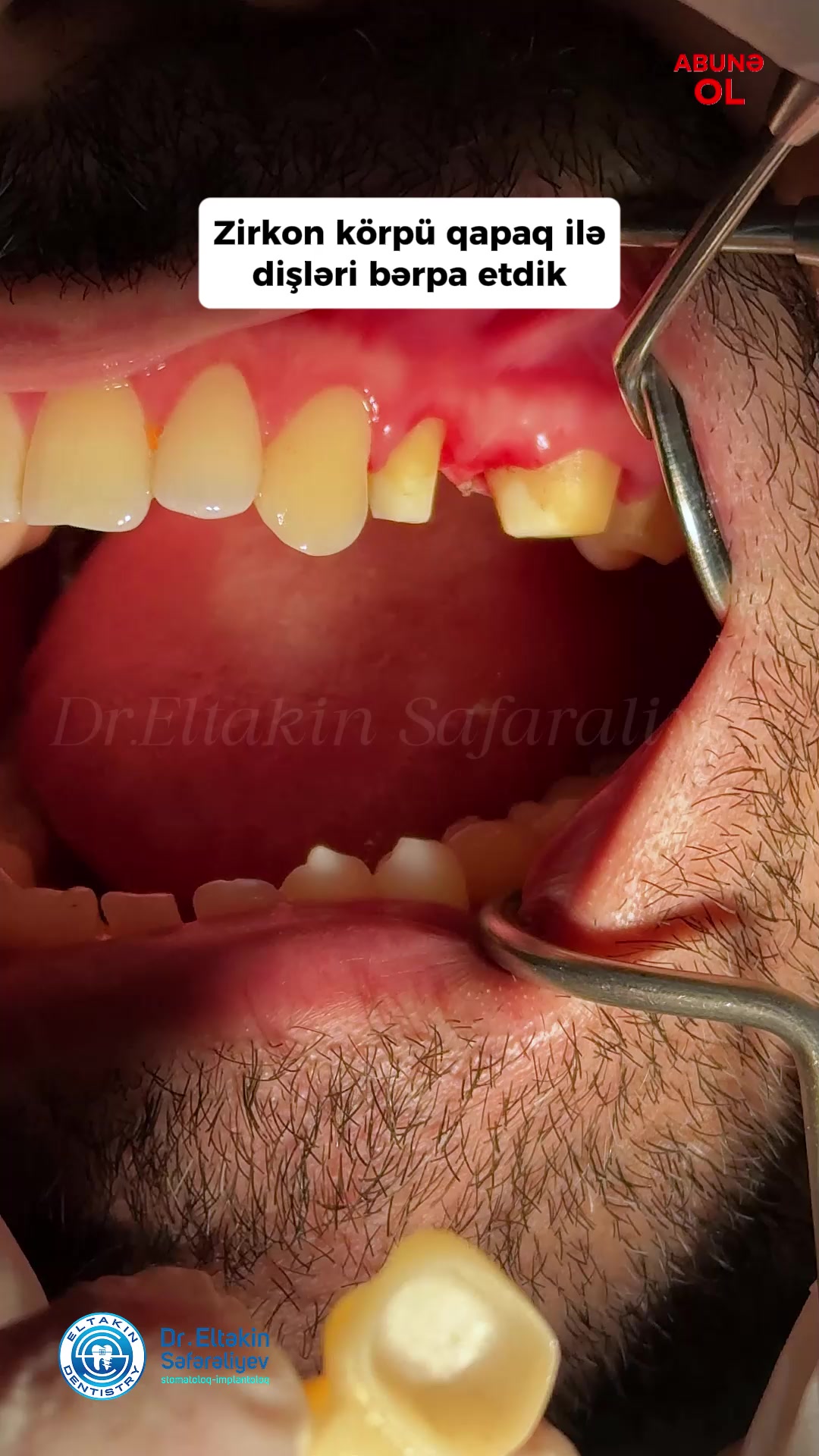 @eltakindentistry