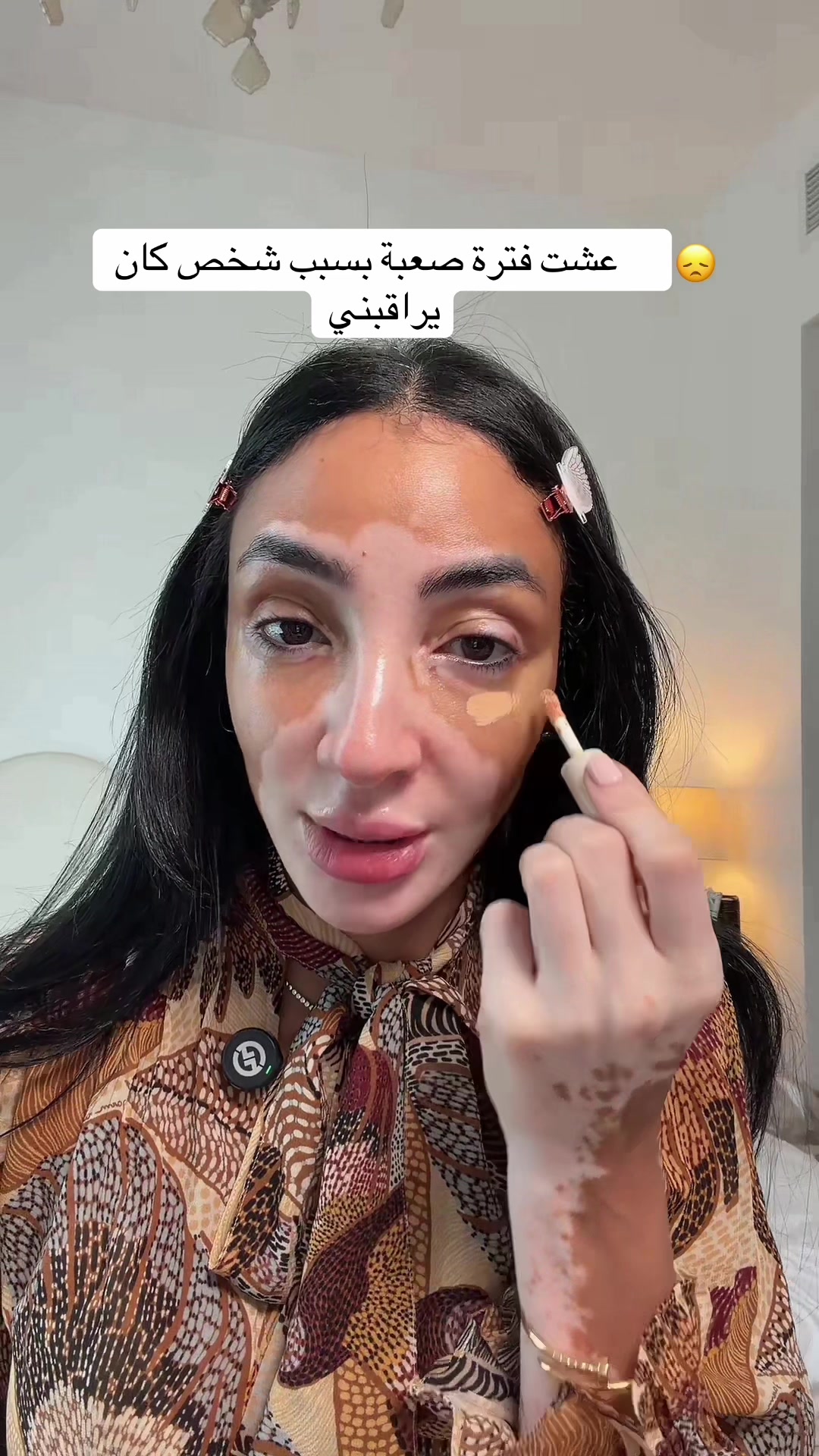 @Logina Salah