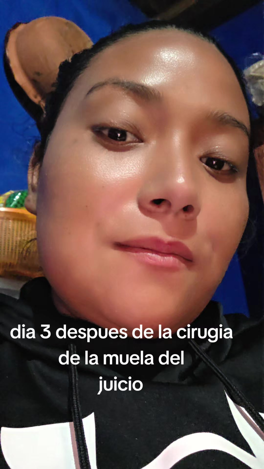 @Leidy Bartolon