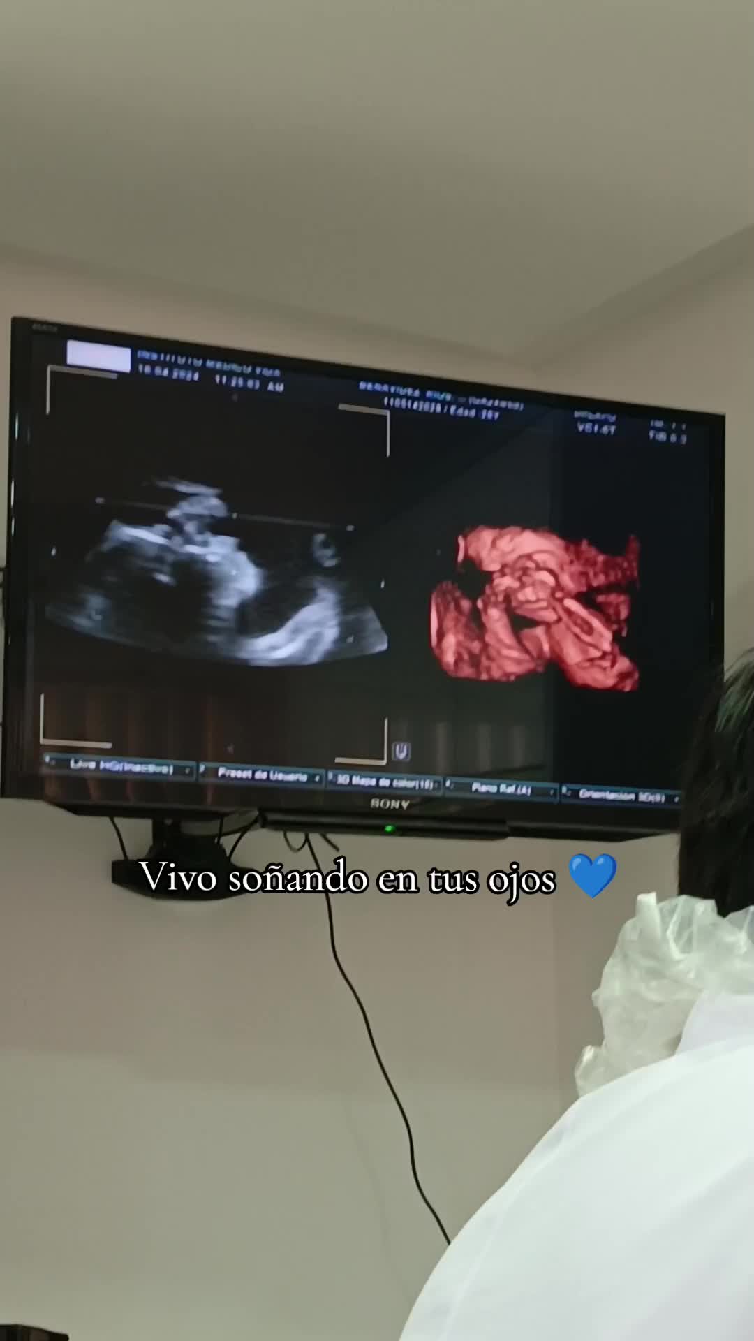 @karo_95