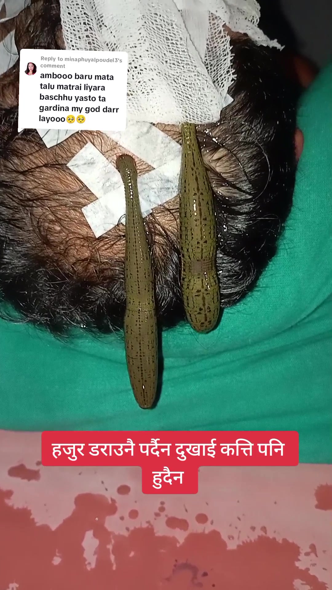 @Bramha Ayurveda