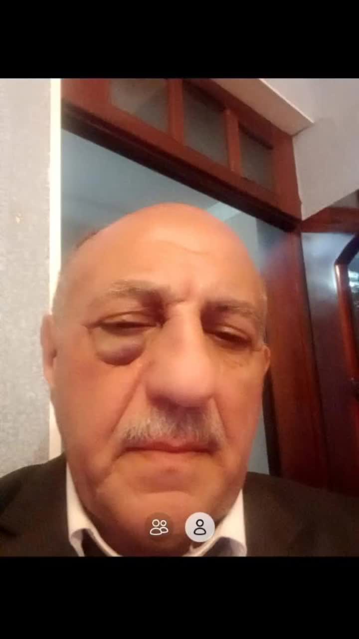 @Xirdalan