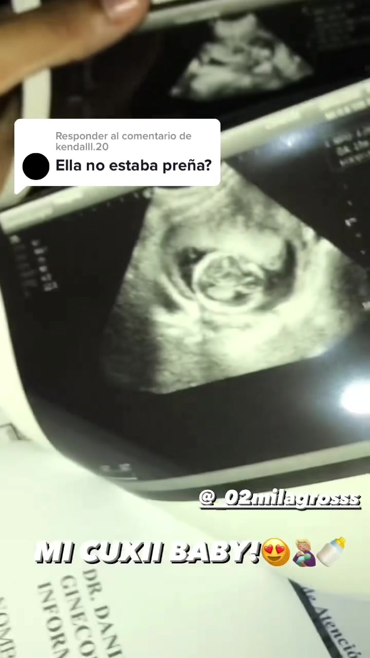 @Cuxiitoo