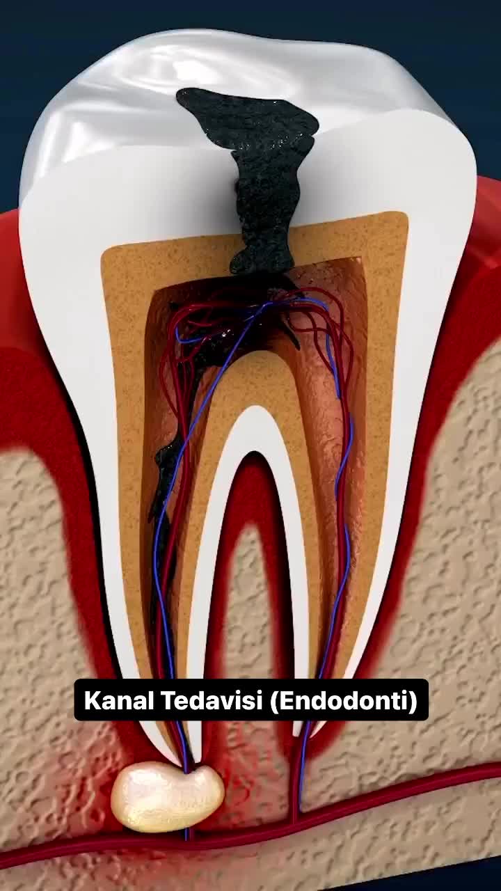 @Doktor Gözü