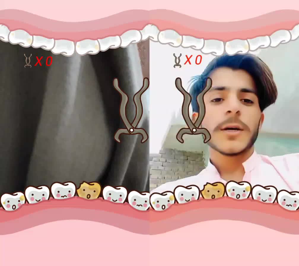 @Hashir 167