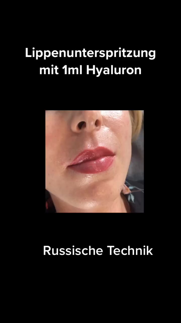 @PrettyDoc D&uuml;sseldorf