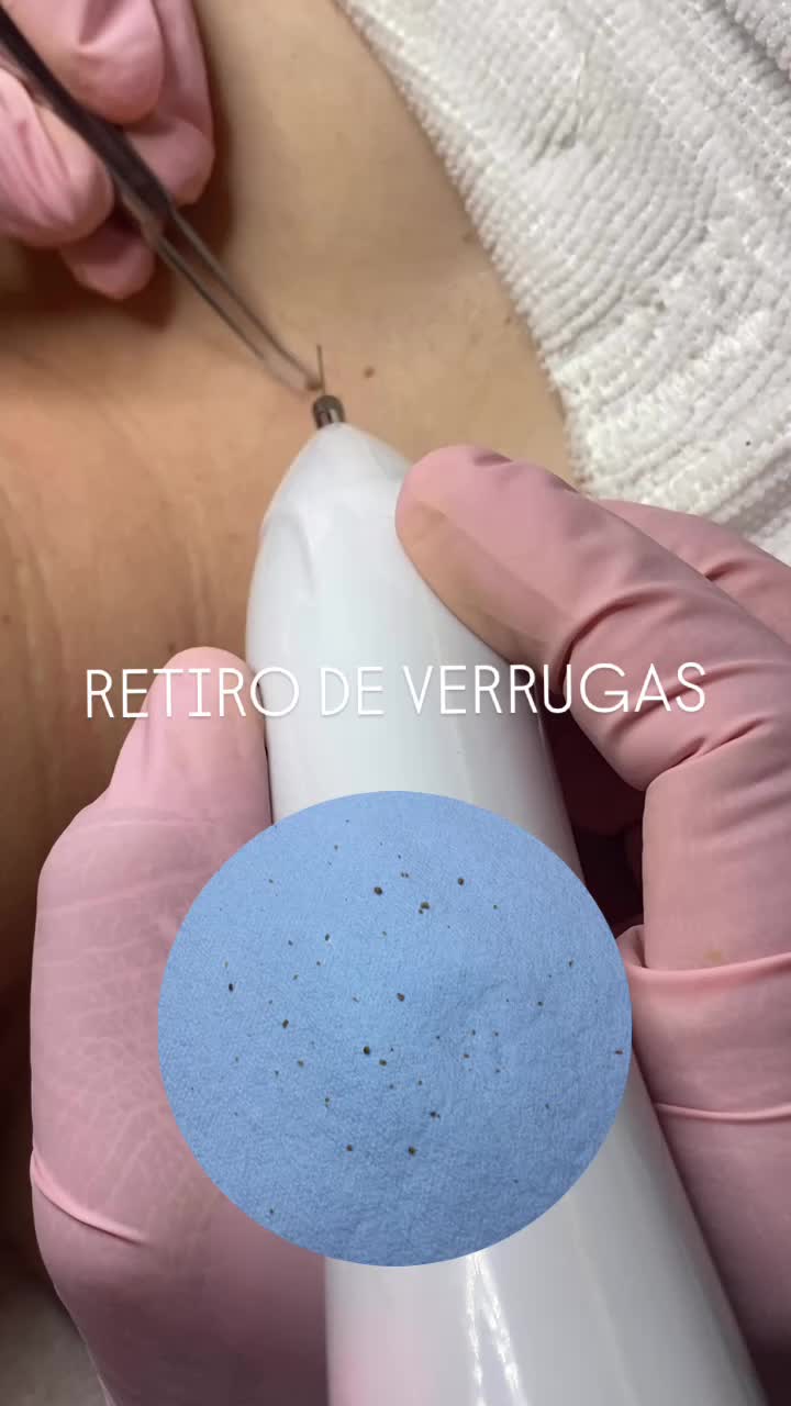 @C&eacute;lula SPA