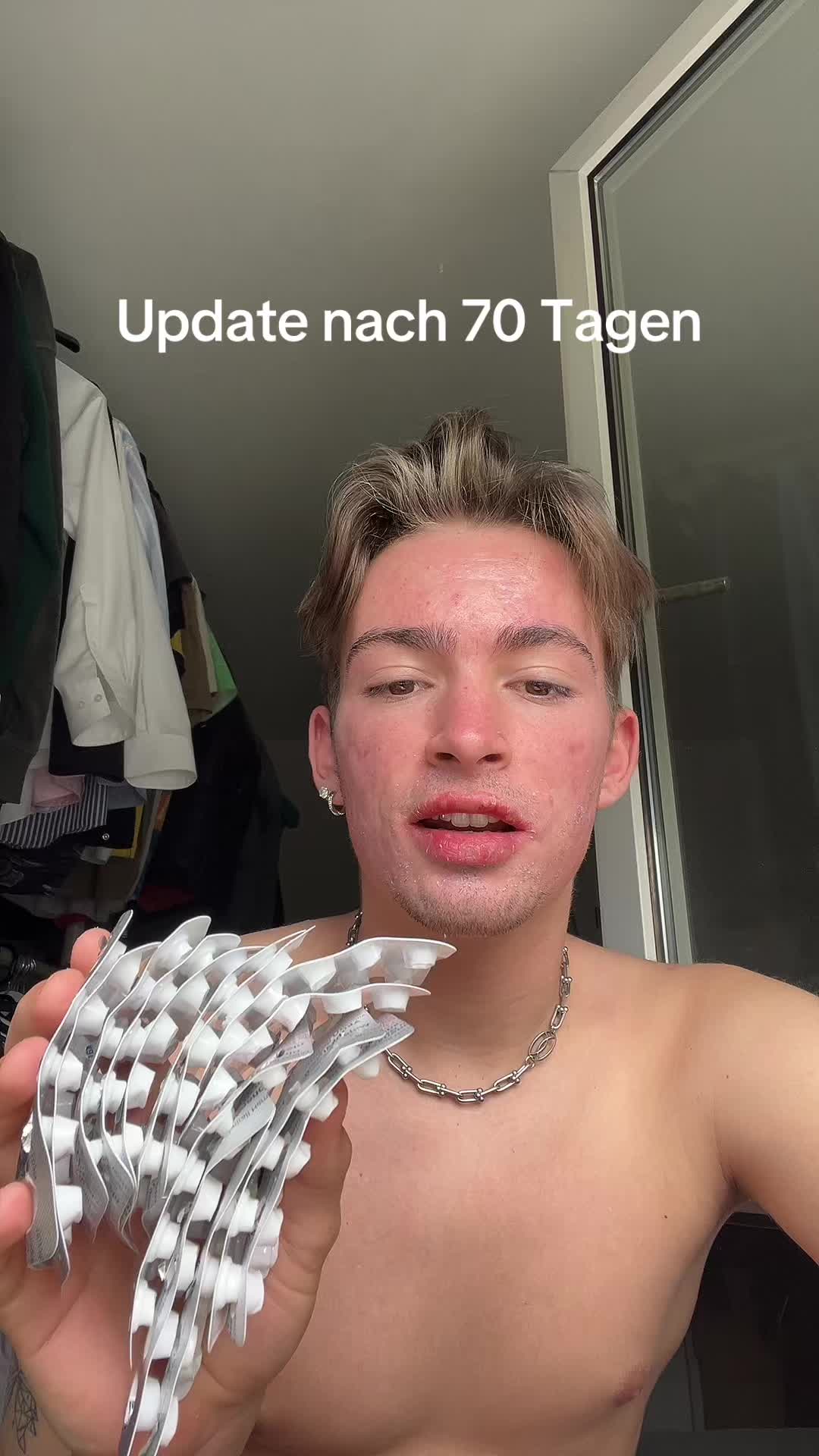 @Tom