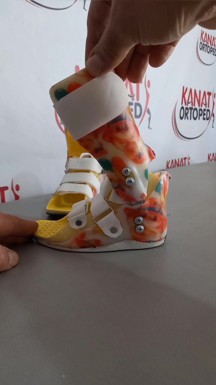 @KanatOrtopedi