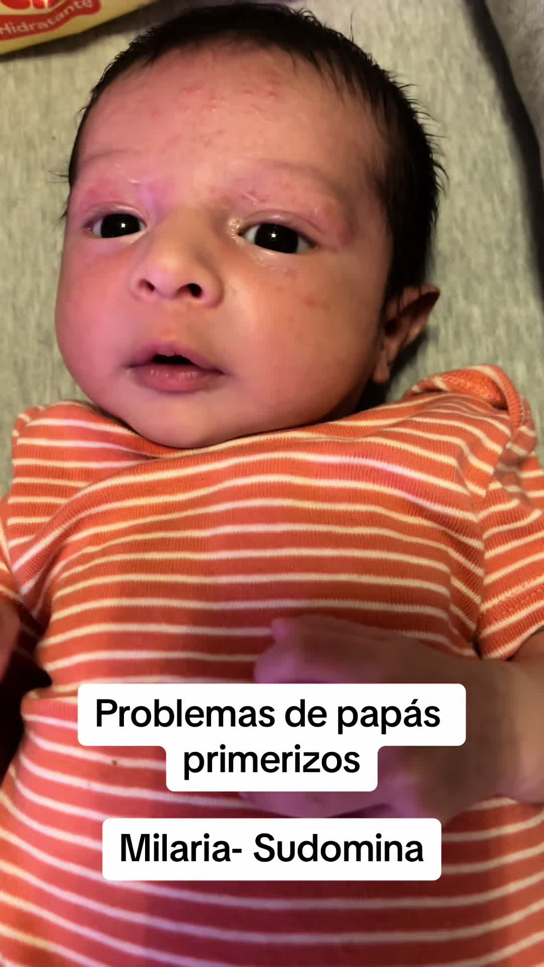 @Diana Alc&aacute;ntara