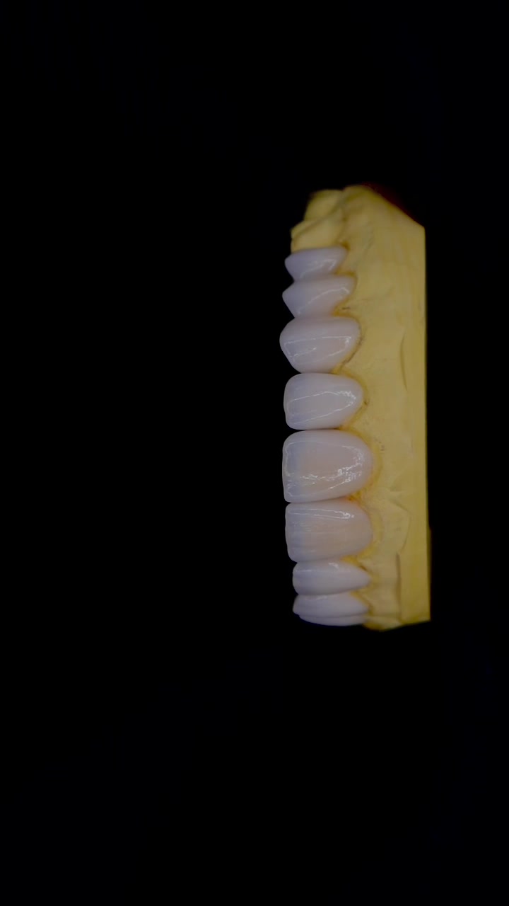 @Utah Valley Dental Lab