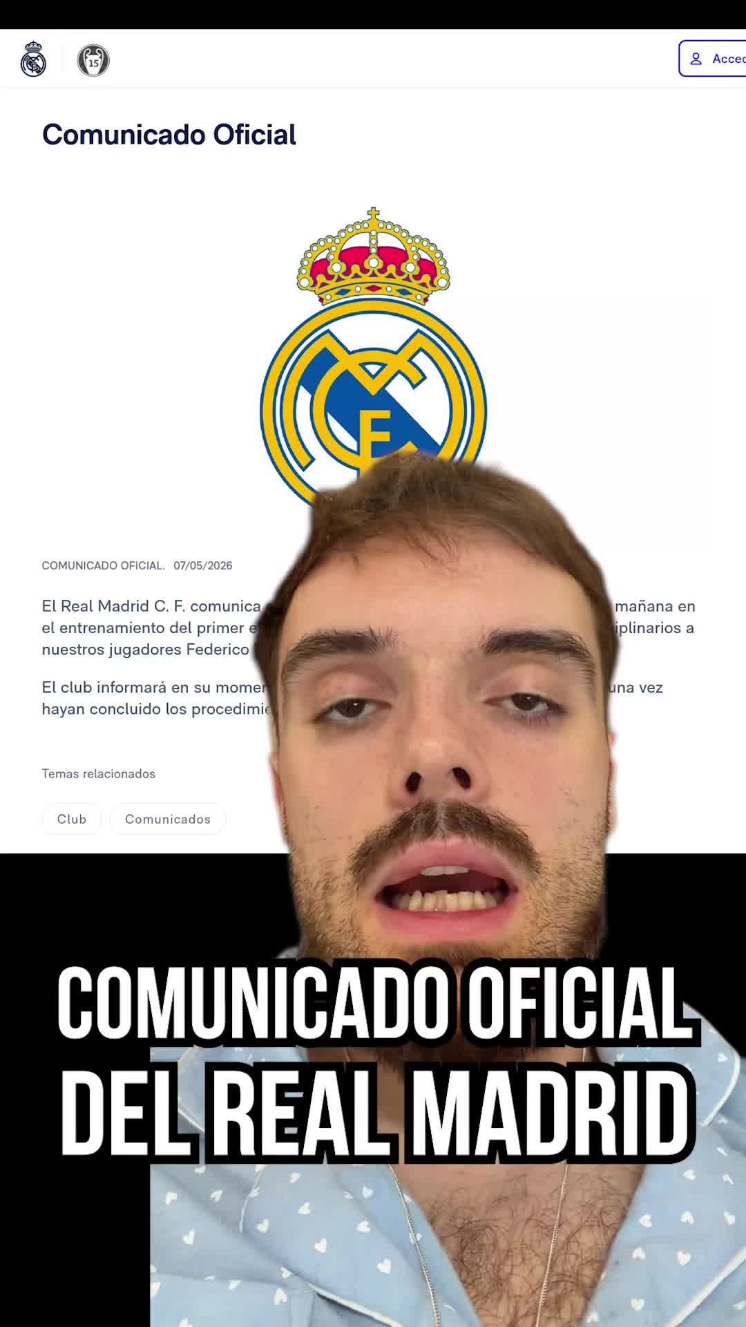 @Ibai