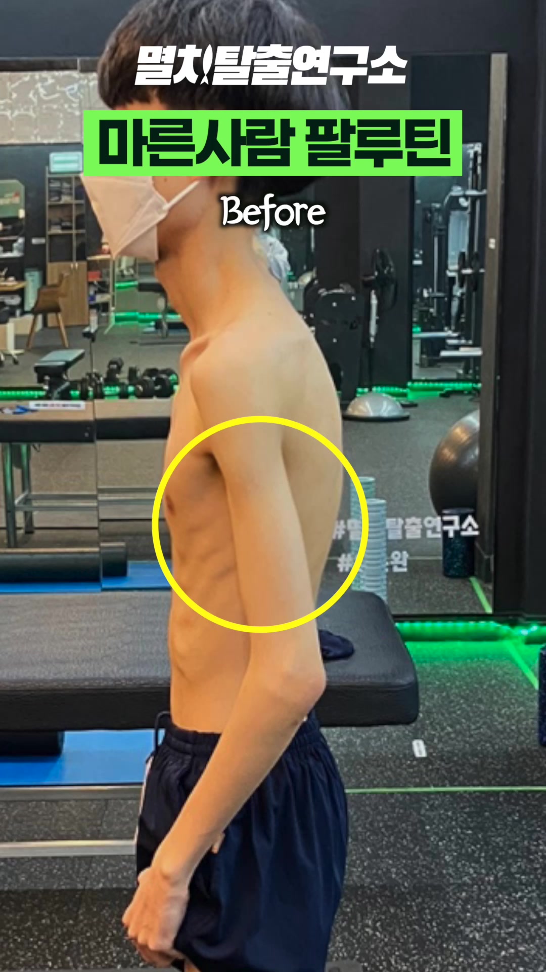 @멸치탈출연구소