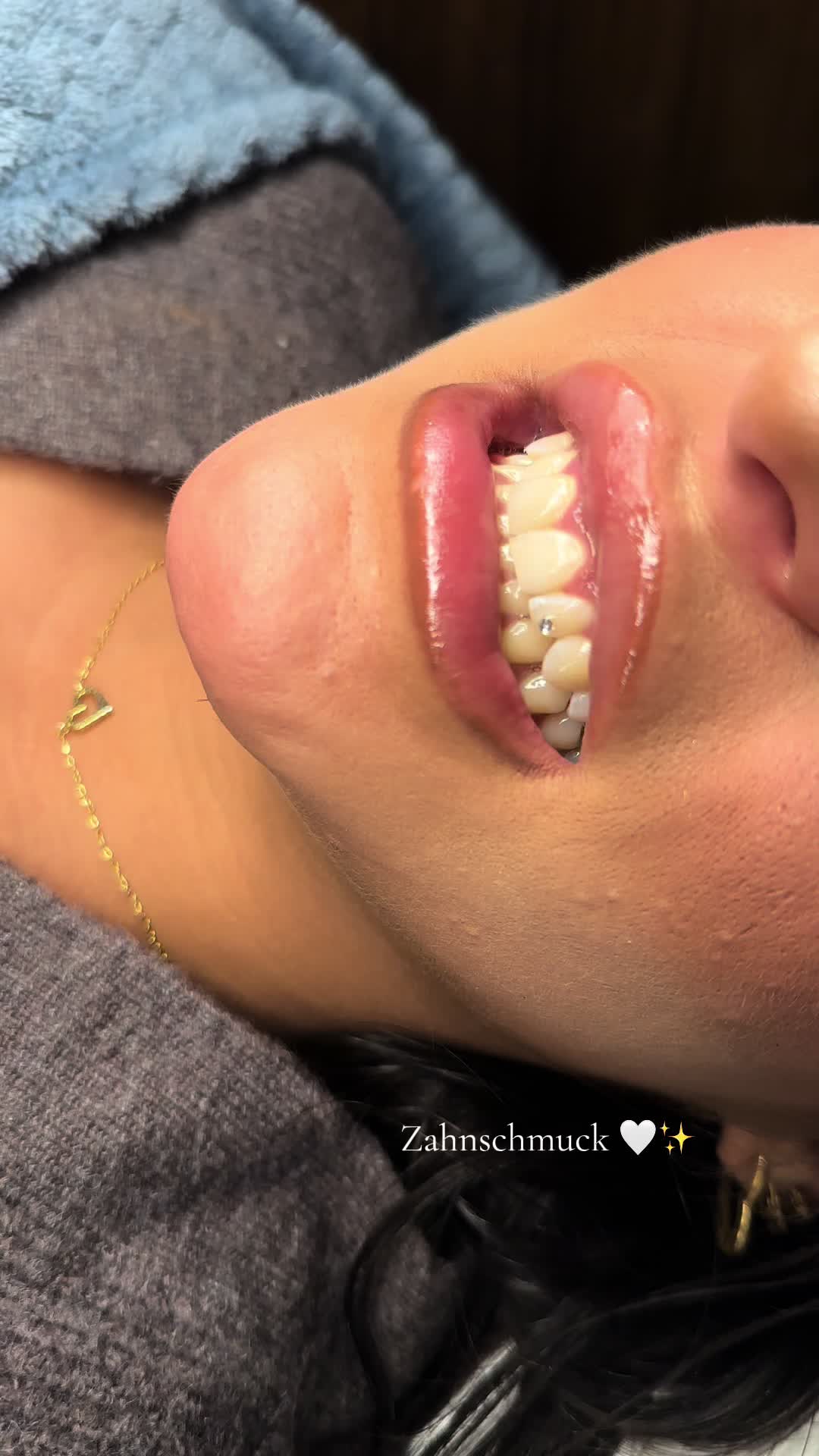 @Zahnschmuck_