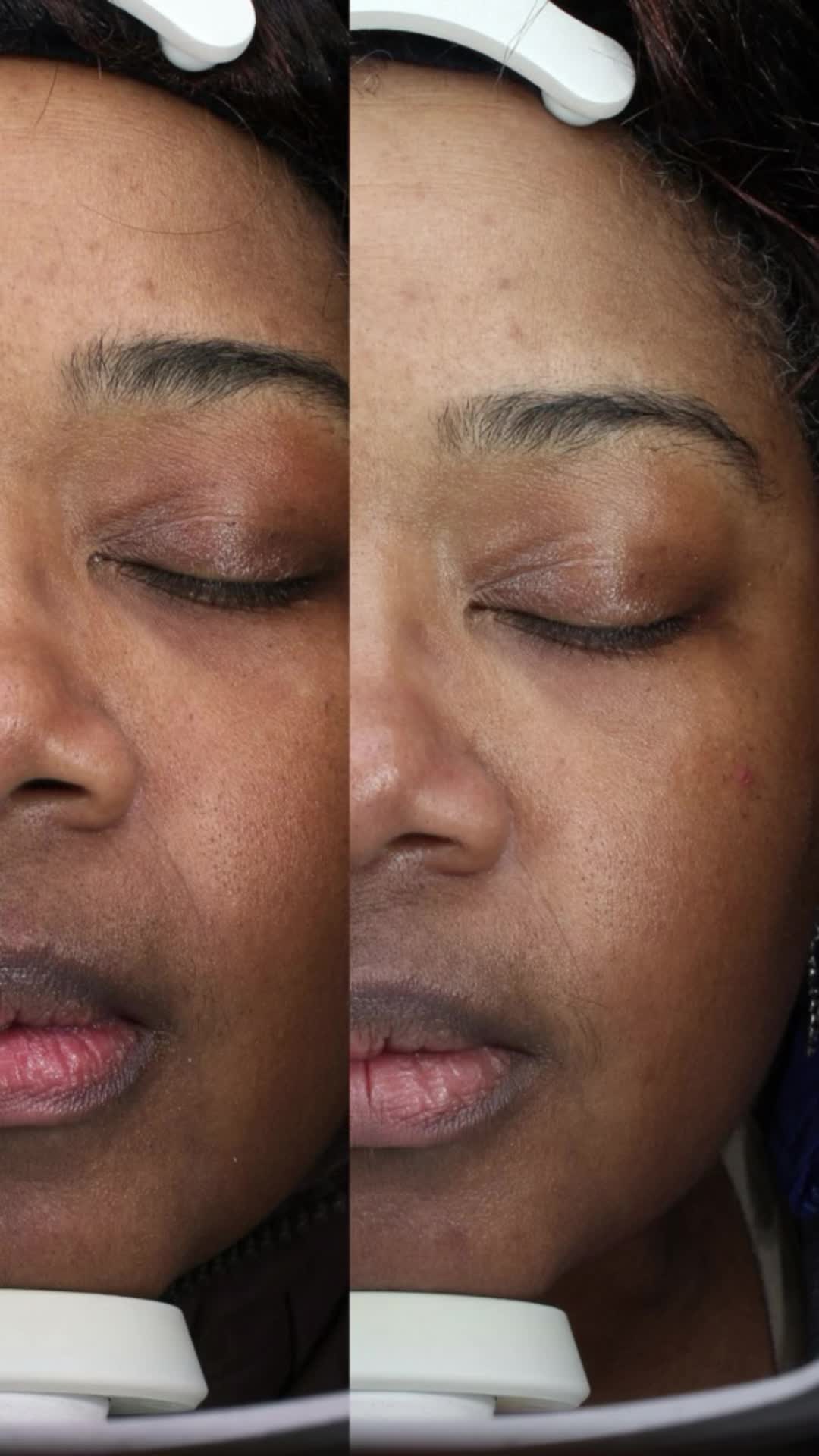 @IKNOW Skincare