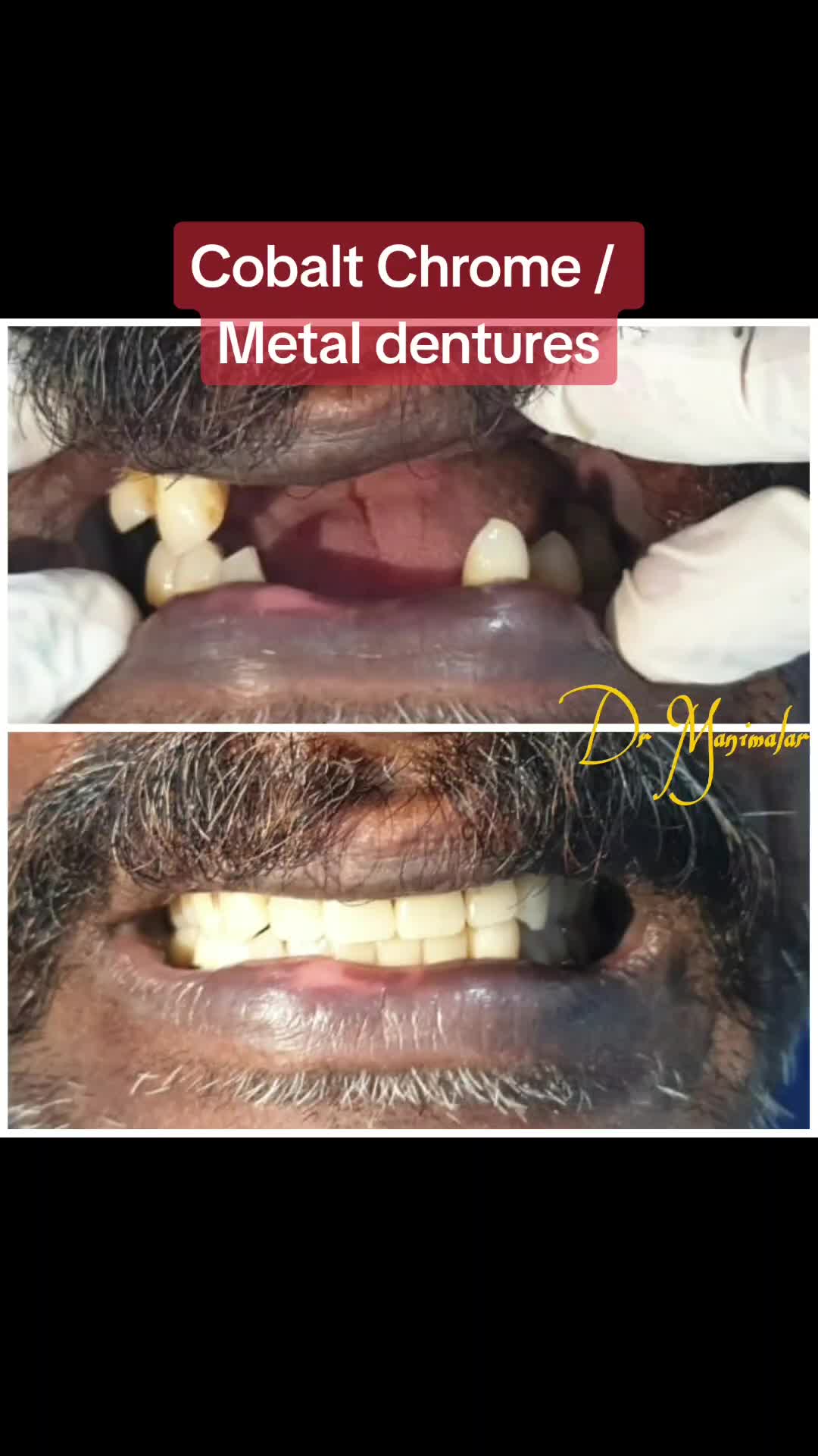 @Dr Manimalar (மணிமலர்)