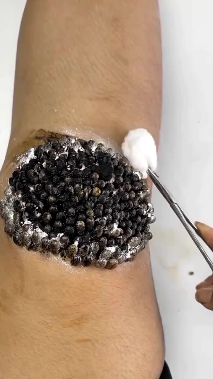 @tickyouu