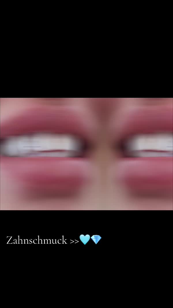 @Zahnschmuck_