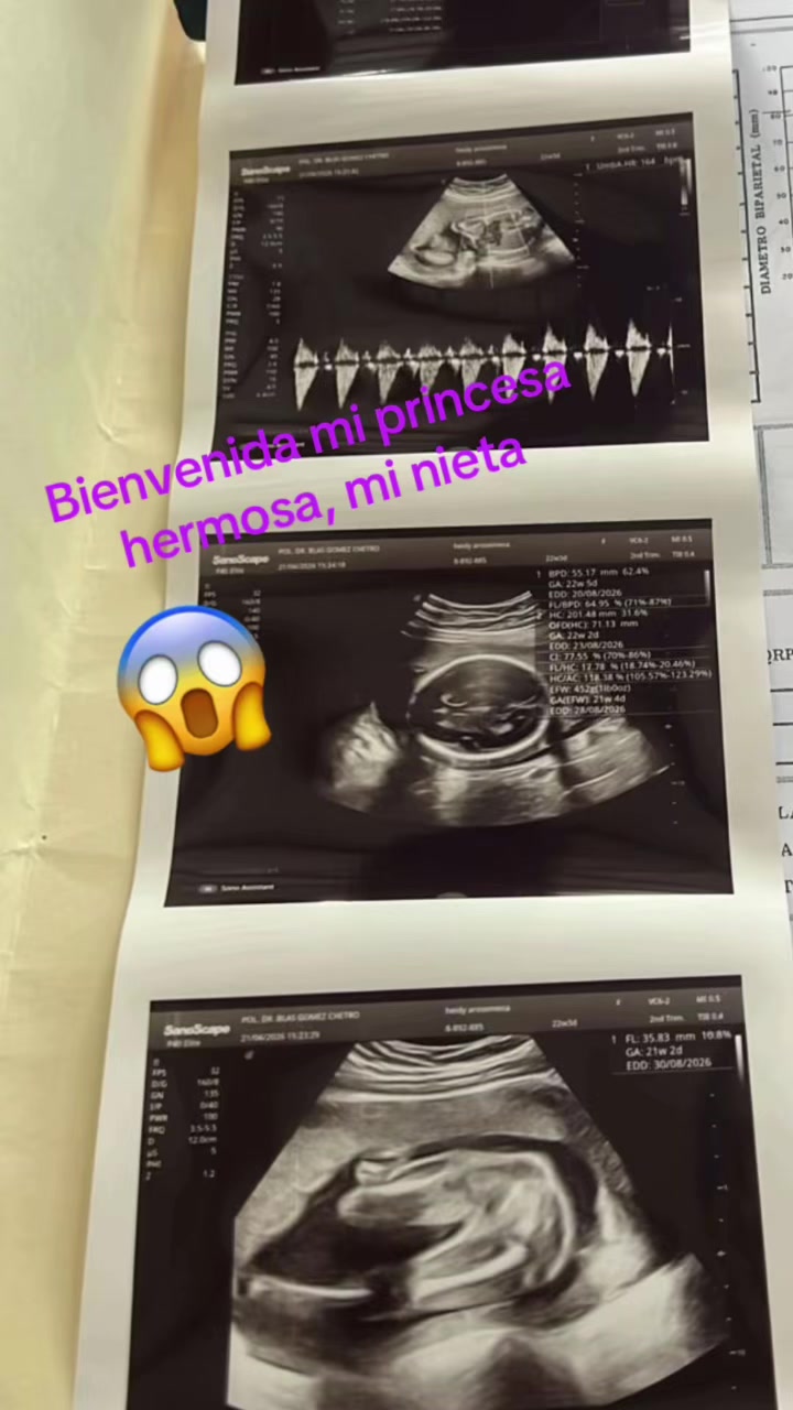 @Isa Quintero