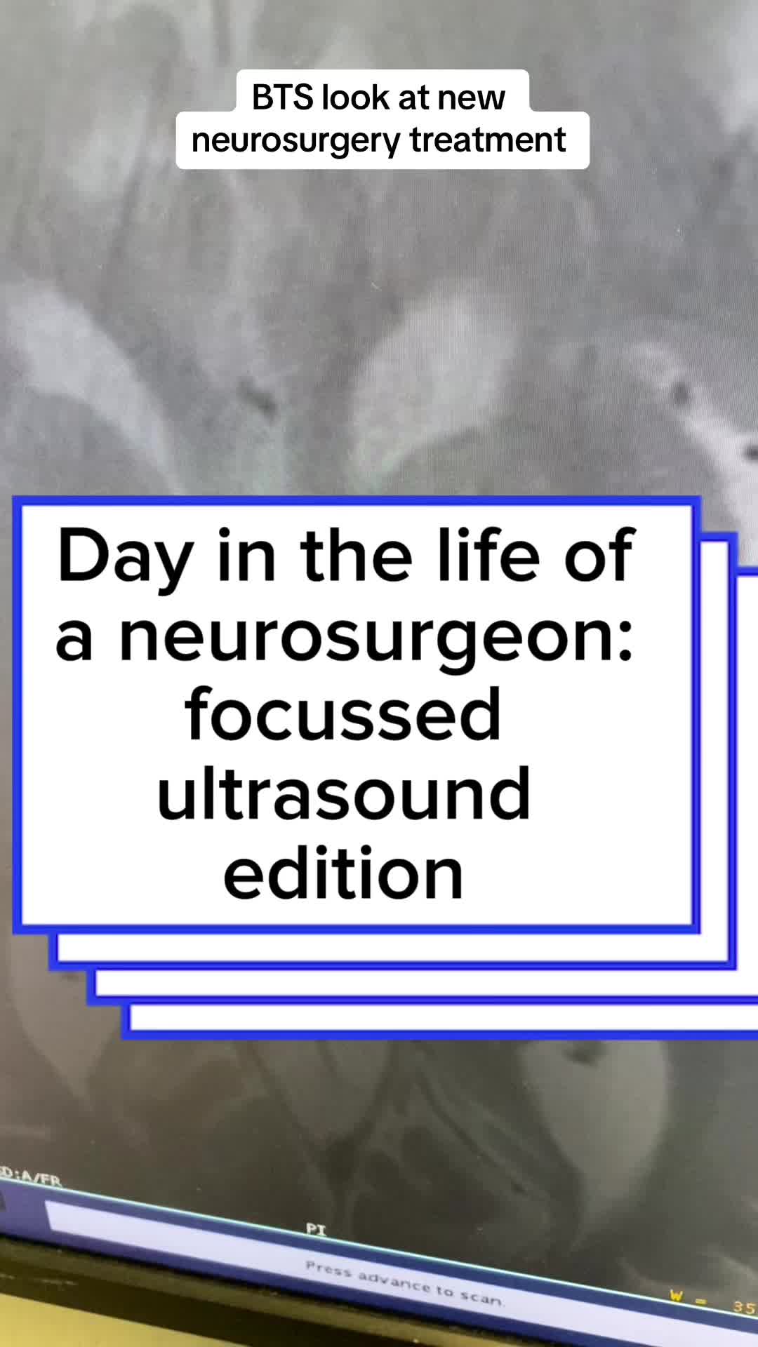@Braindoc