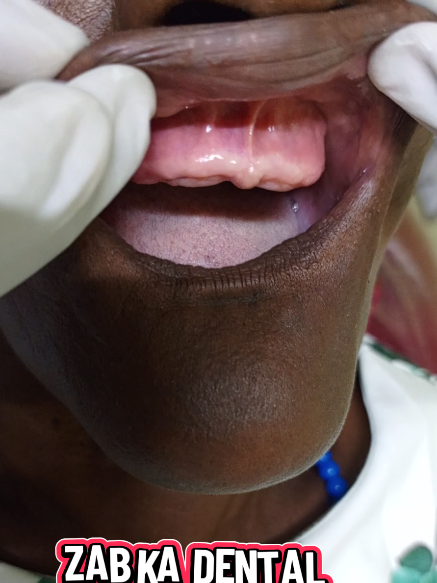 @Zabka Dental