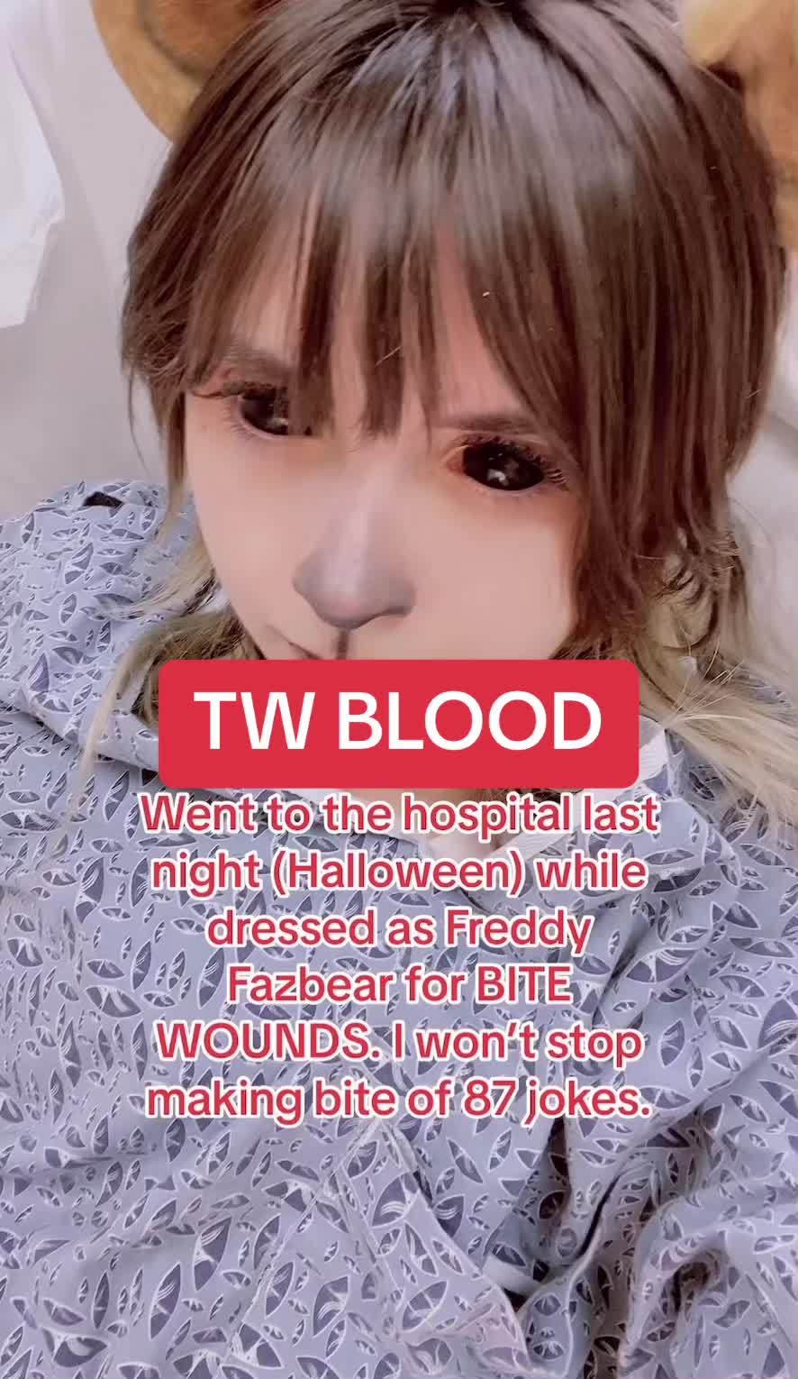 @BB