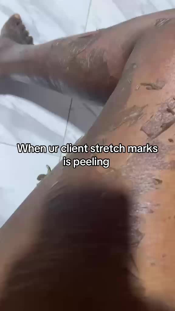 @@ Precious peeling soap