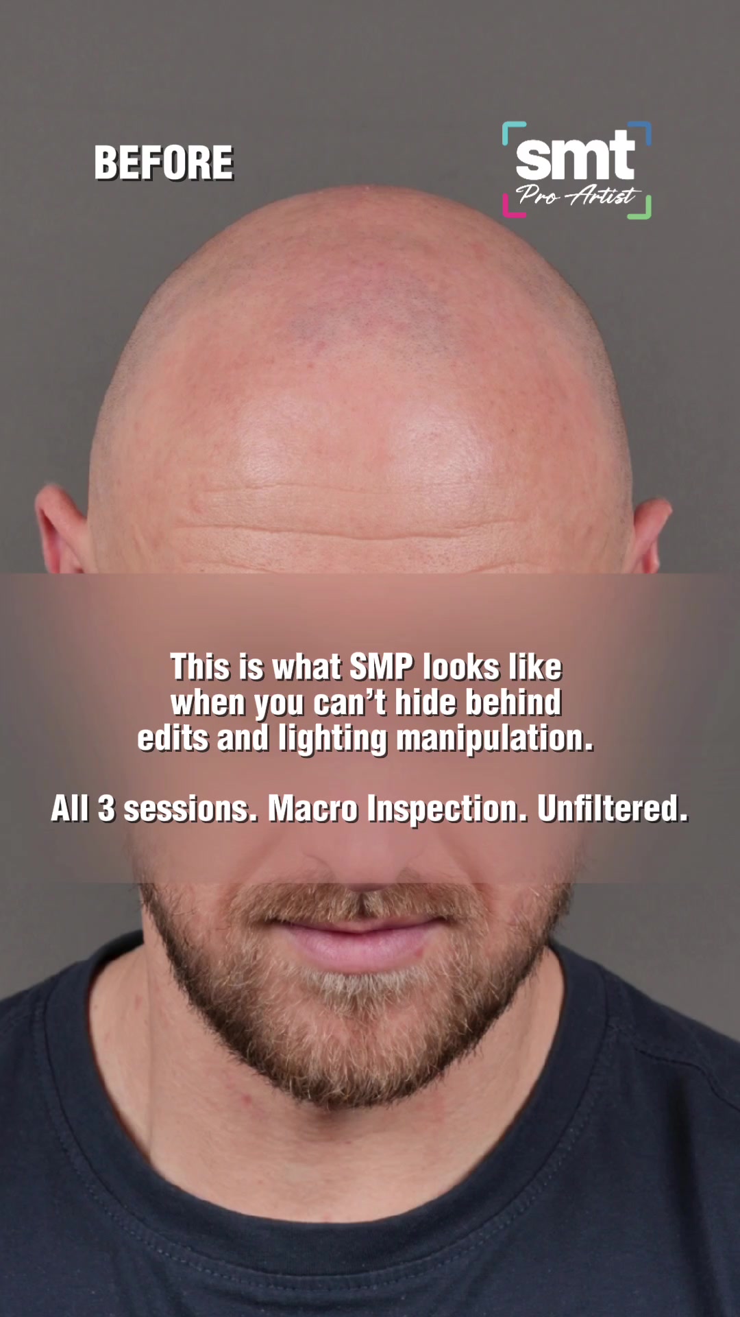 @Enhanced Scalp